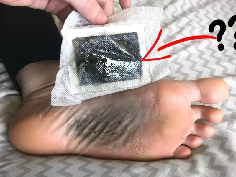 Patch Detoks Kaki Patch detoks kaki ditempatkan di bagian bawah kaki dan dikatakan dapat membuang racun dari dalam tubuh.