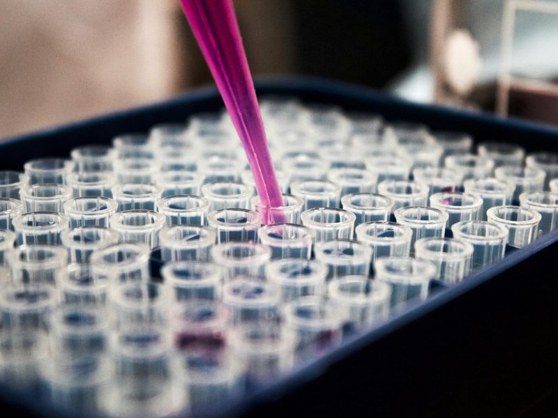 Proses Laboratorium: Menggunakan Pipet dalam Uji Coba Pipet mengisi tabung reaksi dengan cairan berwarna ungu di laboratorium